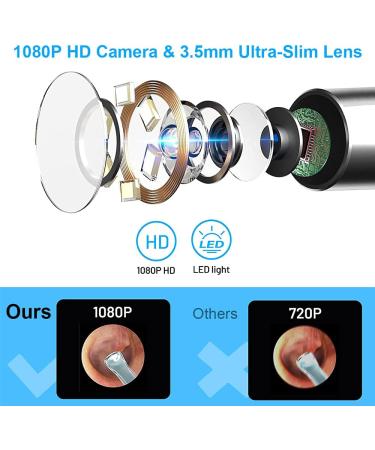 1080P HD Earwax Removal Tool | Waterproof | Easy to Use | 3.5mm Ear Camera with 6 LED Lights | For iOS & Android | Kids & Adults - Buy Online on GoSupps.com