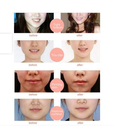 V Line Mask Double Chin Reducer V Shaped Moisturizing Face Mask Tightening Lifting Face Slim Mask Patch - Buy Online on GoSupps.com