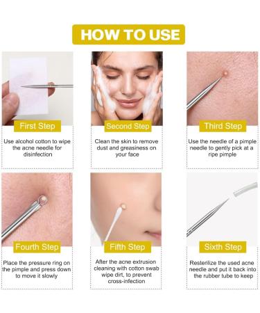 iSmartPart 20Pcs Blackhead Remover Tools Kit - Professional Stainless Steel Acne Extraction Set for Face and Nose - Buy Online on GoSupps.com