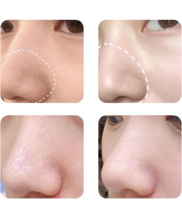 Streysisl Electric Facial Cleansing Brush Facial Cleansing Brush Face Scrubber | Soft Silicone Rotating Cleansing Brush 2-in-1 Design for Deep Clean & Gentle Exfoliation - Buy Online on GoSupps.com
