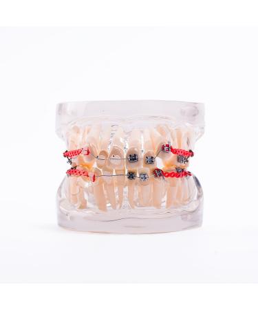 Easyinsmile Dental Orthodontic Treatment Model Teeth/Tooth/Denture Model with Braces for Dentist Studying Researching and Patient Education (Metal&Ceramic)