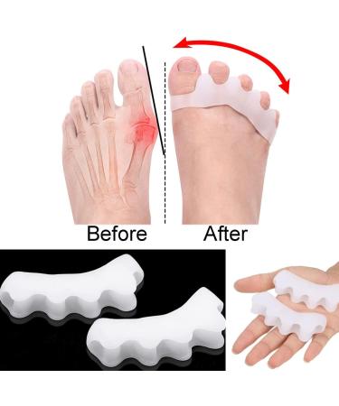 zoerbufan Toe Separators 3 Pair Toe Stretcher for Overlapping Toes to Relax Toes Silicone Toe Straighteners for Hallux Valgus Soft Gel Toe Spacers for Correct Bunions (Transparent) - Buy Online on GoSupps.com