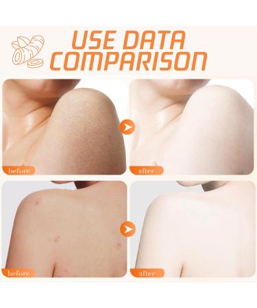 Turmeric Body Scrub - Exfoliating Body Scrub - Vitamin C Remove Dead Skin Fade Dark Spots Body Exfoliator - Deep Cleansing Body Scrub Exfoliator - Face Scrub Exfoliator for Women Men 250g - Buy Online on GoSupps.com