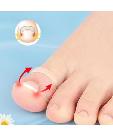 10Pcs Silicone Ingrown Toenail Correcting Tool Professional Paronychia Treatment Corrector Relieve Discomfort Recover Flexible and Elastic Silicone - Buy Online on GoSupps.com