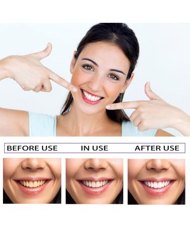 Whitening Toothpaste for Bright Teeth | Natural Stain Removal & Gum Repair - Buy Online on GoSupps.com