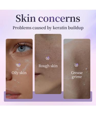 BEAUTNICE Exfoliating Peeling Gel Acid Peel Face & Body Exfoliant Scrub Soft Skin Cleansing Wash Remove Dead Skin Cells for Men and Women(1 box per pack) - Buy Online on GoSupps.com