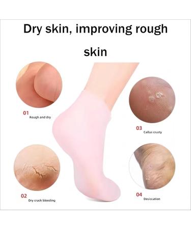 BAIYSFFG 2 Pairs Moisturizing Socks Silicone Moisturizing Socks Anti Slip Aloe Socks for Dry Cracked Feet Women & Softening Dry Cracked Feet Rough Skins Calluses Spa Gel Socks Foot Care After Pedicure - Buy Online on GoSupps.com