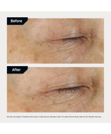 Buy Revision Skincare D E J Eye Cream - Firming & Moisturizing Treatment for Fine Lines Wrinkles & Crow's Feet - 0.5 fl oz - International Shipping Available - Buy Online on GoSupps.com