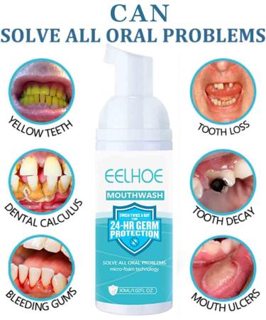 EELHOE Teeth Whitening Foam Toothpaste - Stain Removal Mouthwash - 30ml (2 Pcs) - Buy Online on GoSupps.com