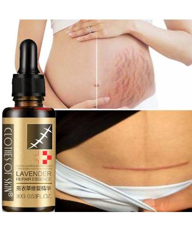Hotiary Scar Removal Serum - Lavender Repair Essence 30g (1 Pack) - Skin Repair for Cuts, Stretch Marks, Burns & Postoperative Scars - Buy Online on GoSupps.com