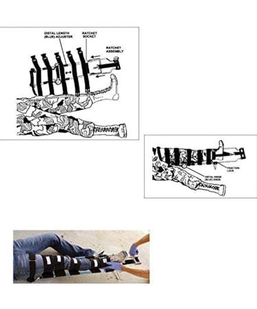 Adjustable Leg Traction Frame - Aluminum Alloy Set with 4 Belts for Pain Relief & Emergency Rescue | International Shipping - Buy Online on GoSupps.com