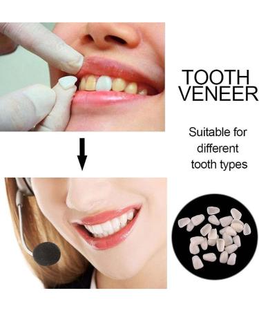 OTCPP Temporary Tooth Repair Kit - 50g Filling Beads & 60pcs Thermal Beads Replacement - Buy Online on GoSupps.com