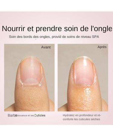Nail and Cuticle Oil 15ml Repairing Treatment for Damaged Nails - Nourishing Treatment for Cracked Nails Compact Travel Cuticle Care Product - Buy Online on GoSupps.com