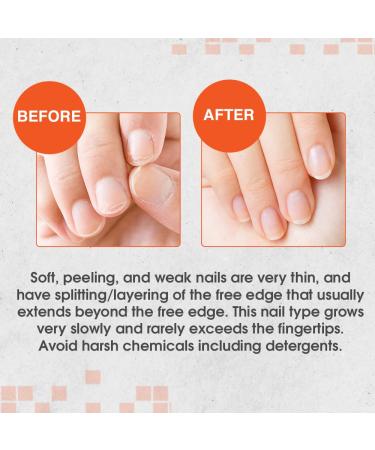 Nail Tek Intensive Therapy 2 Nail Strengthener x 2-Pack for Soft and Peeling Nails - 0.5 oz - Buy Online on GoSupps.com