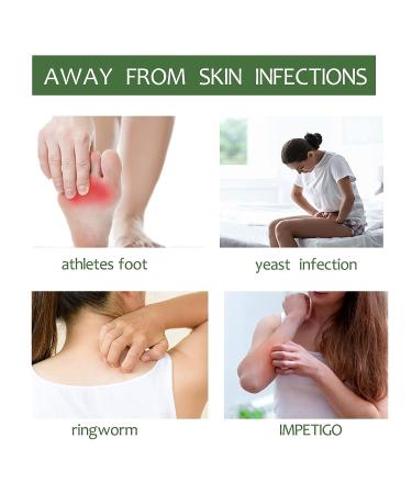 Natouch Antifungal Medicated Soap Bar 4oz - Tea Tree, Eucalyptus, Lavender - Athletes Foot, Jock Itch, Ringworm, Yeast Infection Treatment - Buy Online on GoSupps.com