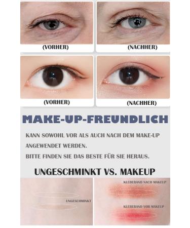 384 Piece Eyelid Lifting Stripes - Invisible Breathable Mesh Eye Tape | Skin Color | 3 Sizes | International Shipping - Buy Online on GoSupps.com