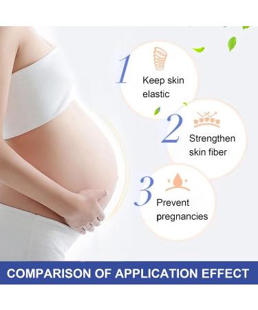 Stretch Strip Oil - Essential Massage Oil for Stretch Marks & Skin Care Treatment - Buy Online on GoSupps.com