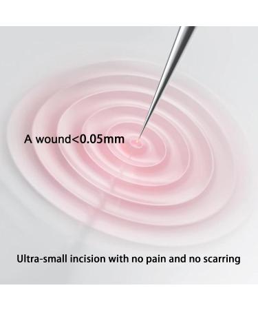 Color Blackhead Tool Kit Stainless Steel Acne Needles Double Side Spot Squeezer Tool Pimple Popper Tool Kit Whitehead Removal (Colorful) - Buy Online on GoSupps.com