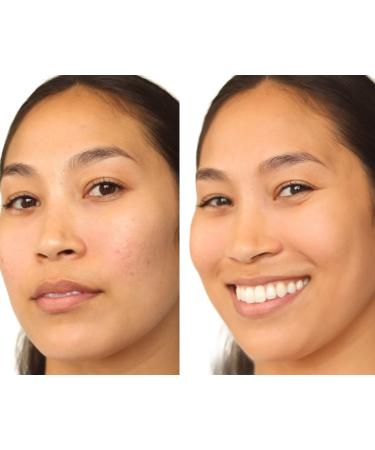 Buy BE YOU SKIN Skin Perfecting Tint | RICH - Original Skin Tint by per-fekt | International Shipping Available - Buy Online on GoSupps.com