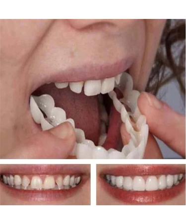 FCcassiel 2 PCS Fake Teeth Veneers Dentures for Women Men - Temporary Tooth Repair and Comfortable Dental Veneers - Protect Your Teeth and Regain Confident Smile - Multicolor - Buy Online on GoSupps.com