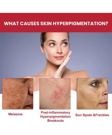 Dajidafu Women Face Whitening Brightening Girls Natural Ingredient Moisturizing Essence Female Portable Stock Solution - Buy Online on GoSupps.com