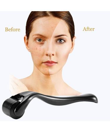 Derma Roller 540 Titanium Microneedle Roller for Face Facial Wrinkles Hair Loss Stretch Marks Hair Regrowth Micro Needles Professional Microneedling Derma Needling Kit with Case (0.25mm) - Buy Online on GoSupps.com