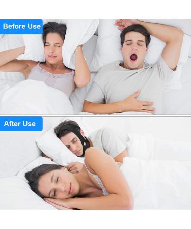 Anti-Snoring Chin Strap for Mouth Breathers - Adjustable and Breathable - Black - Buy Online on GoSupps.com