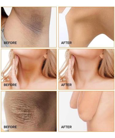 Underarm Whitening Cream Cr me Blanchissante Whitening Cream Cr me claircissante pour Aisselles Skin Lightening Cream Armpit Whitening Cream Efficace pour les Aisselles Les Coudes - Buy Online on GoSupps.com