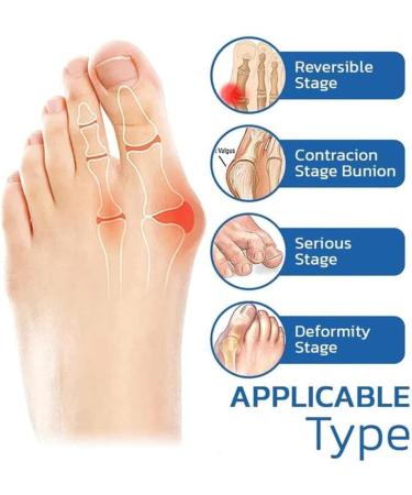 Pochy Orthoes Bunion Relief Socks - One Size Compression Socks for Women and Men - Buy Online on GoSupps.com