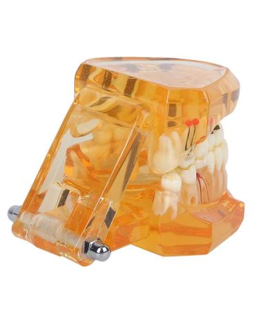 Standard Tooth Model - Removable Dental Teaching Materials for Kids & Adults | Typodont Demonstration Model - Buy Online on GoSupps.com