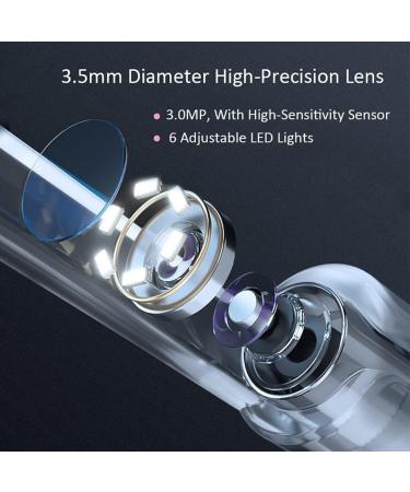 KouRy Earwax Removal Tool with Camera Earwax Cleaner Tools 3.9mm Ear Otoscope Wireless Ear Otoscope Earwax Cleaner Kit for Android & iOS Ideal Gift - Buy Online on GoSupps.com