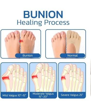 Pochy Orthoes Bunion Relief Socks - One Size Compression Socks for Women and Men - Buy Online on GoSupps.com