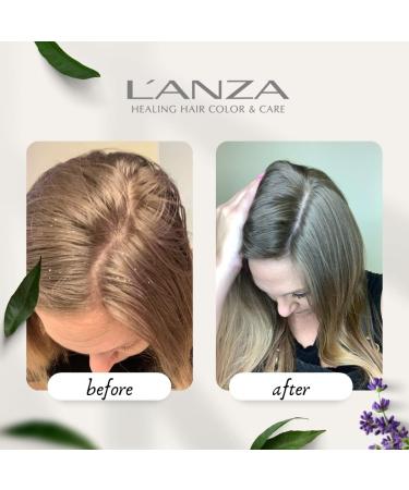 L'ANZA Healing Remedy Scalp Balancing Cleanser - Papaya Extract, Sulfate-Free, Paraben-Free, Gluten-Free (266ml) - Buy Online on GoSupps.com