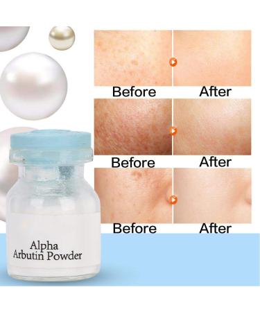 3g Skin Whitening Lightening Powder | Arbutin Powder for Radiant Facial Care - Brightens & Glows Skin - Buy Online on GoSupps.com