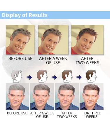 Restoria Discreet Cream and Lotion 250ml - Restore Natural Hair Color - Buy Online on GoSupps.com