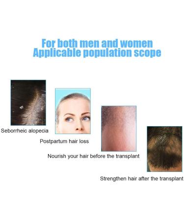 Hair Growth Helmet Device Anti Hair Loss Promote Hair Growth Hair Growth Helmet Beautymisc & Cap System Hair Growth For For Men And Women Device(Black-Uk) - Buy Online on GoSupps.com