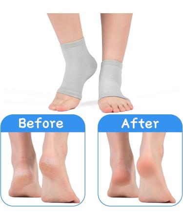 DCC-GETS Moisturizing Gel Socks for Women- 2 Pairs, Cracked Heel Treatment- Beige - Buy Online on GoSupps.com