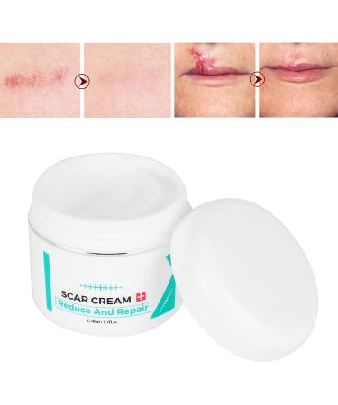 Scar Removal Cream - Pregnancy, Acne, Facial & Skin Repair Treatment Gel - Buy Online on GoSupps.com