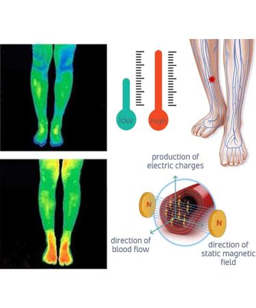 Neocare Anti Ankle Edema Socks - XL 6pcs Green - Buy Online on GoSupps.com