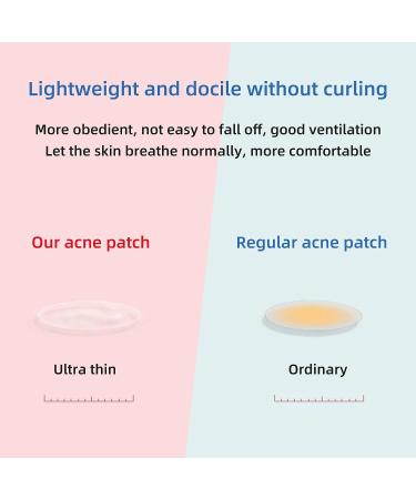 ovand Acne Pimple Patches - Ultra-Thin Hydrocolloid Spot Stickers for Face - 72 Acne Dots - Extra Adhesion Zit Patch - Optimal Healing Treatment - Buy Online on GoSupps.com