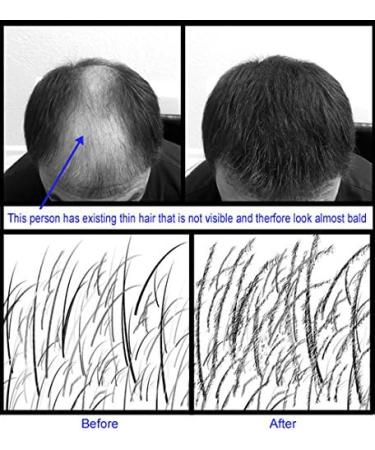 Refill kit Hair Fiber By Samson XLarge 50 Grams Hide Hair Loss and Hair Transplant Natural Looking Results Made in USA Hair Loss Concealer (Dark Blonde) - Buy Online on GoSupps.com