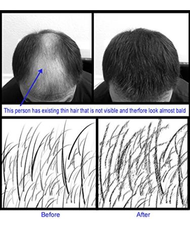 Dark Gray Hair Fiber Refill Kit by Samson | 25g Hair Loss Concealer Made in USA - International Shipping Available - Buy Online on GoSupps.com