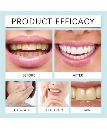 Skavix Peinture Blanchiment Dentaire Skavix Vernis Dentaire Blanc Peinture De Blanchiment Des Dents Instantan e Dent Blanche Pour liminer Les Taches Teeth Whitening Tooth Polish (3) - Buy Online on GoSupps.com