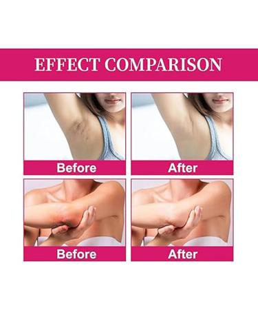  Utapossin Konolic Acid Underarm Cream 2-Pack - Buy Online on GoSupps.com