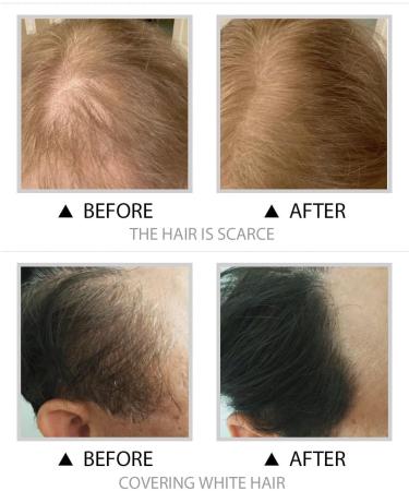 Root Touch Up Powder Hairline Powder Dark Brown Hair Root Colour Touch Up Quick Cover Grey Hair in Hair Regrowth Treatments for Root Concealer-(Black) - Buy Online on GoSupps.com