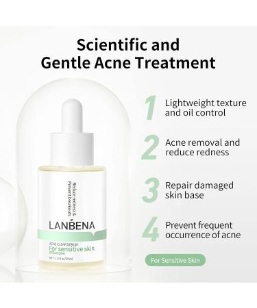 Buy 10% Salicylic Acid Serum - Acne Treatment Minimize Pores & Redness Relief for Sensitive Skin - 30ml - Buy Online on GoSupps.com