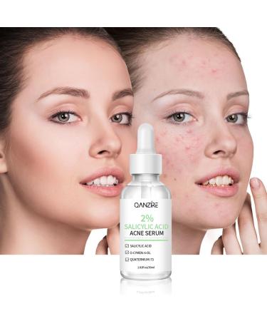 Professional Anti-Acne Treatment Serum - Buy Online on GoSupps.com