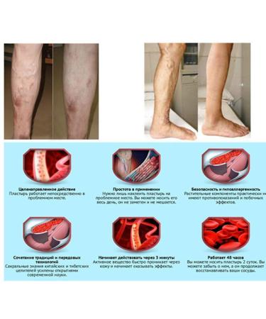 18Pcs Pat Varicose Veins Treatment Plasters - Herbal Medicine for Spider Veins & Vasculitis - Effective Chinese Remedies - Buy Online on GoSupps.com