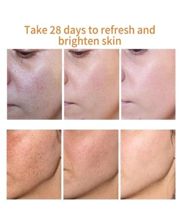 Dark Spot Remover Cream with Alpha Arbutin, Niacinamide, Collagen - for Face, Body & Sensitive Areas- Vitamin E, Bearberry, Vitamin A- Age & Sun Spot Corrector - Buy Online on GoSupps.com
