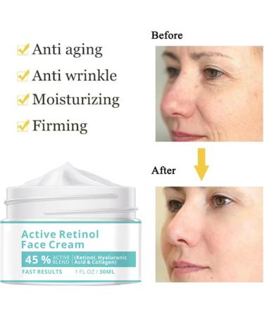 Deep Hydration Face Cream Facial Moisturizer Natural Skin Care Products - Soothing Moisturizing Cream 30ml Skin Softening Cream For Dry Skin & - Buy Online on GoSupps.com